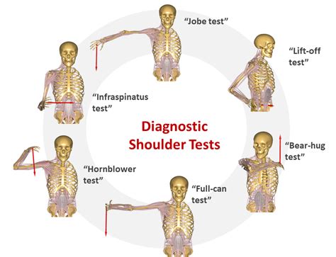 cold cuff test|special tests for rotator cuff.